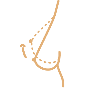 Bioestimuladores